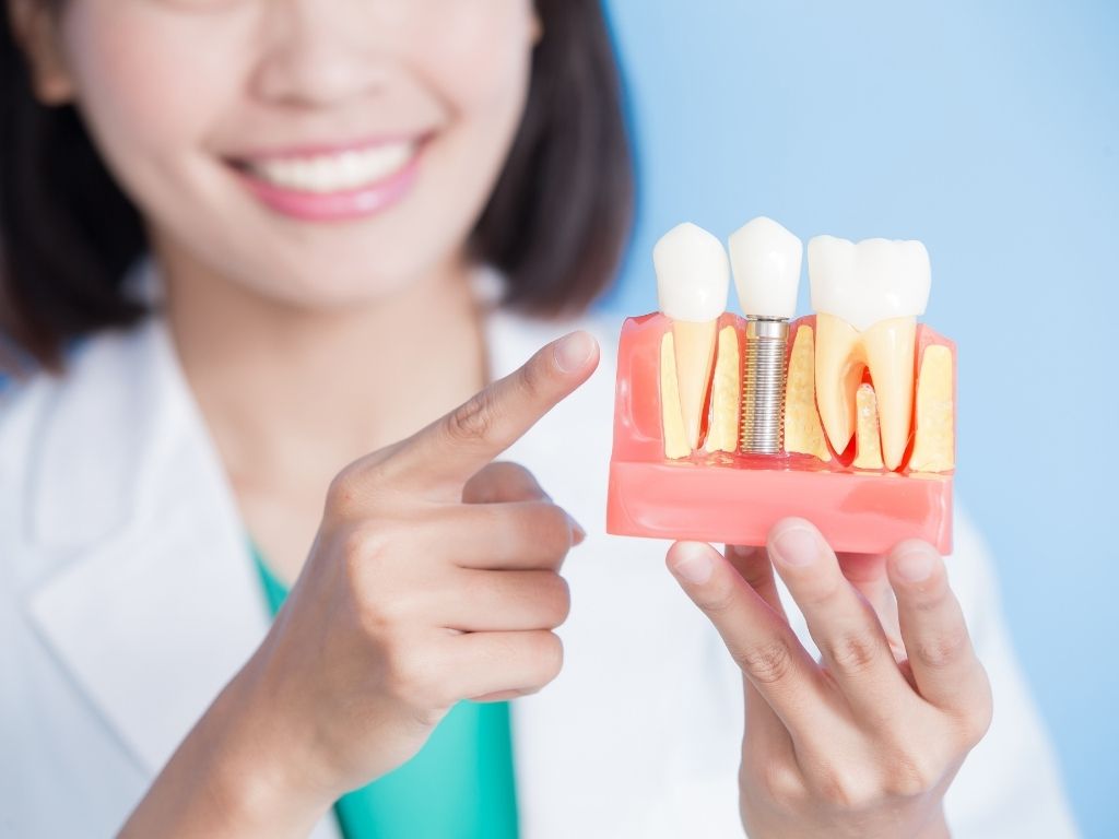Implantes Dentales Odontovital implantes-dentales-odontovital